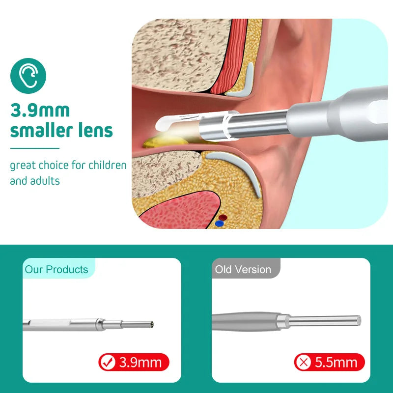Digital Otoscope with Gyroscope 3.9MM 4.5 " IPS Ear Scope Camera 1080P Ear Wax Removal Tool For Home Ear Infection Detector