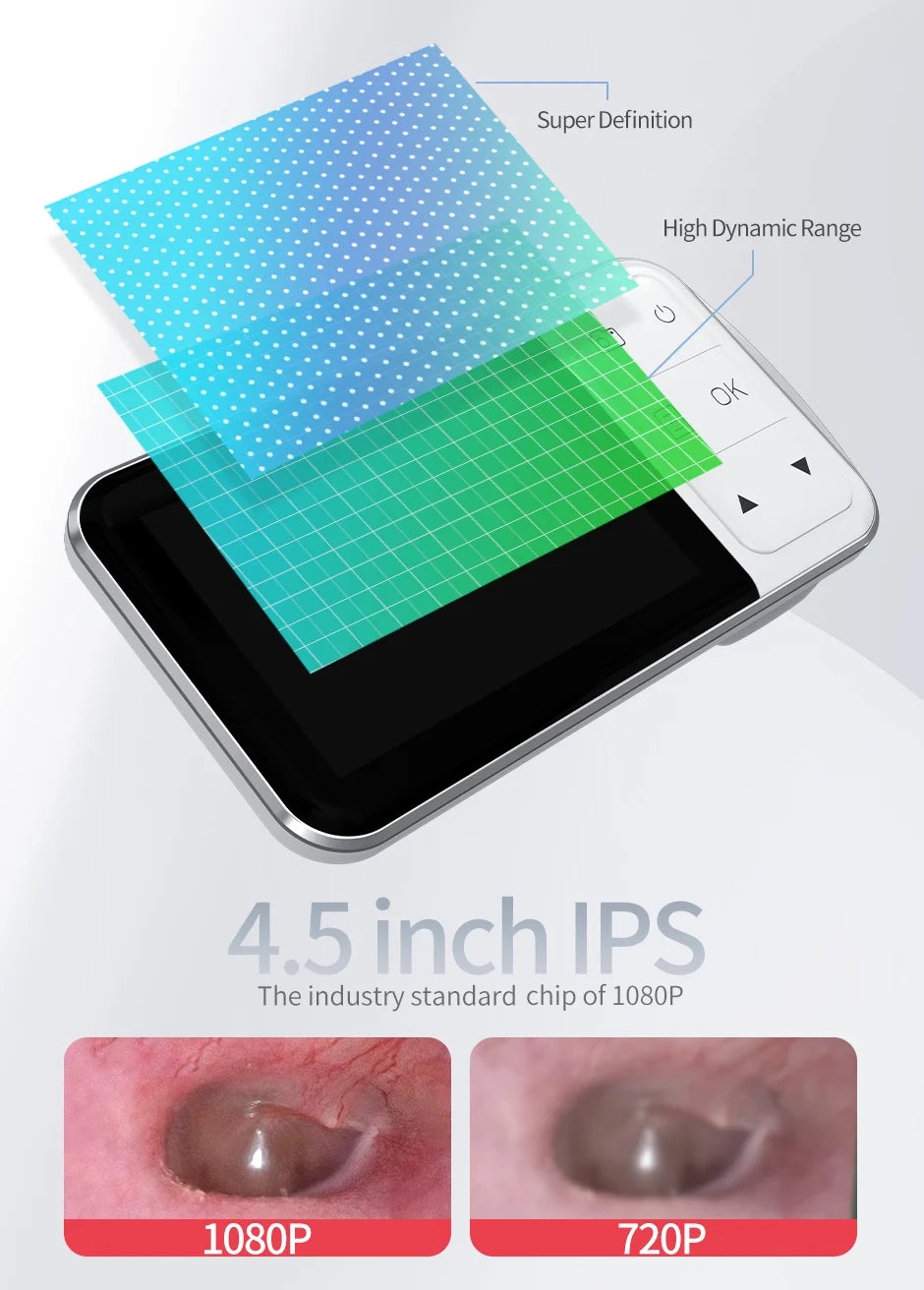 Digital Otoscope with Gyroscope 3.9MM 4.5 " IPS Ear Scope Camera 1080P Ear Wax Removal Tool For Home Ear Infection Detector