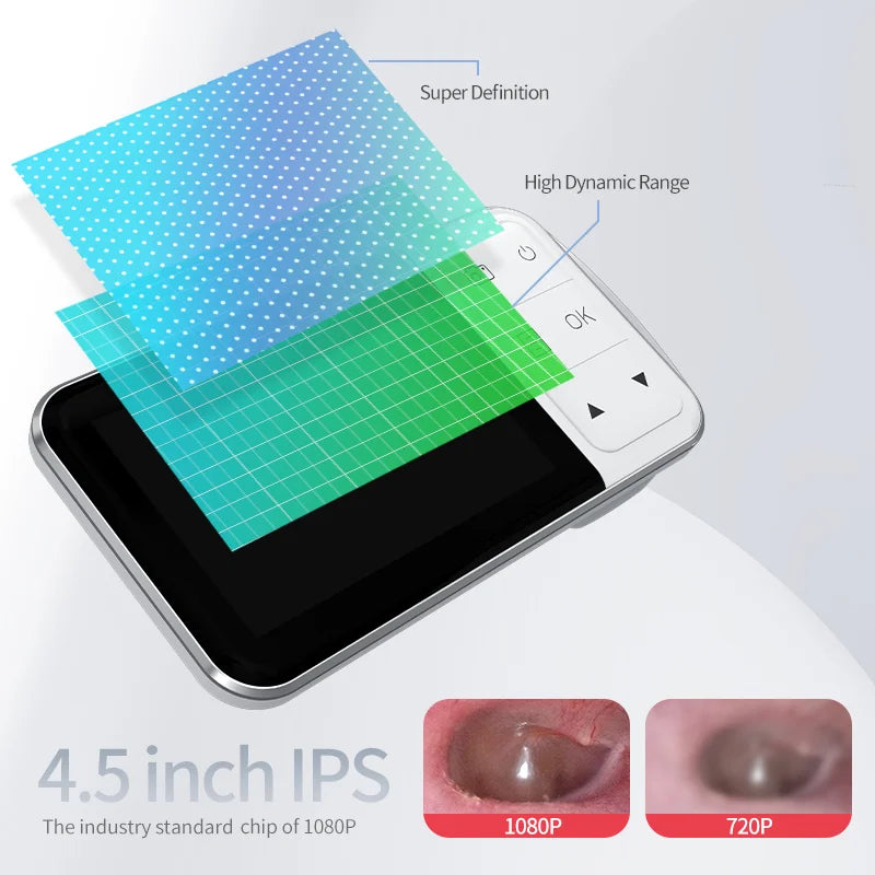 Digital Otoscope with Gyroscope 3.9MM 4.5 " IPS Ear Scope Camera 1080P Ear Wax Removal Tool For Home Ear Infection Detector