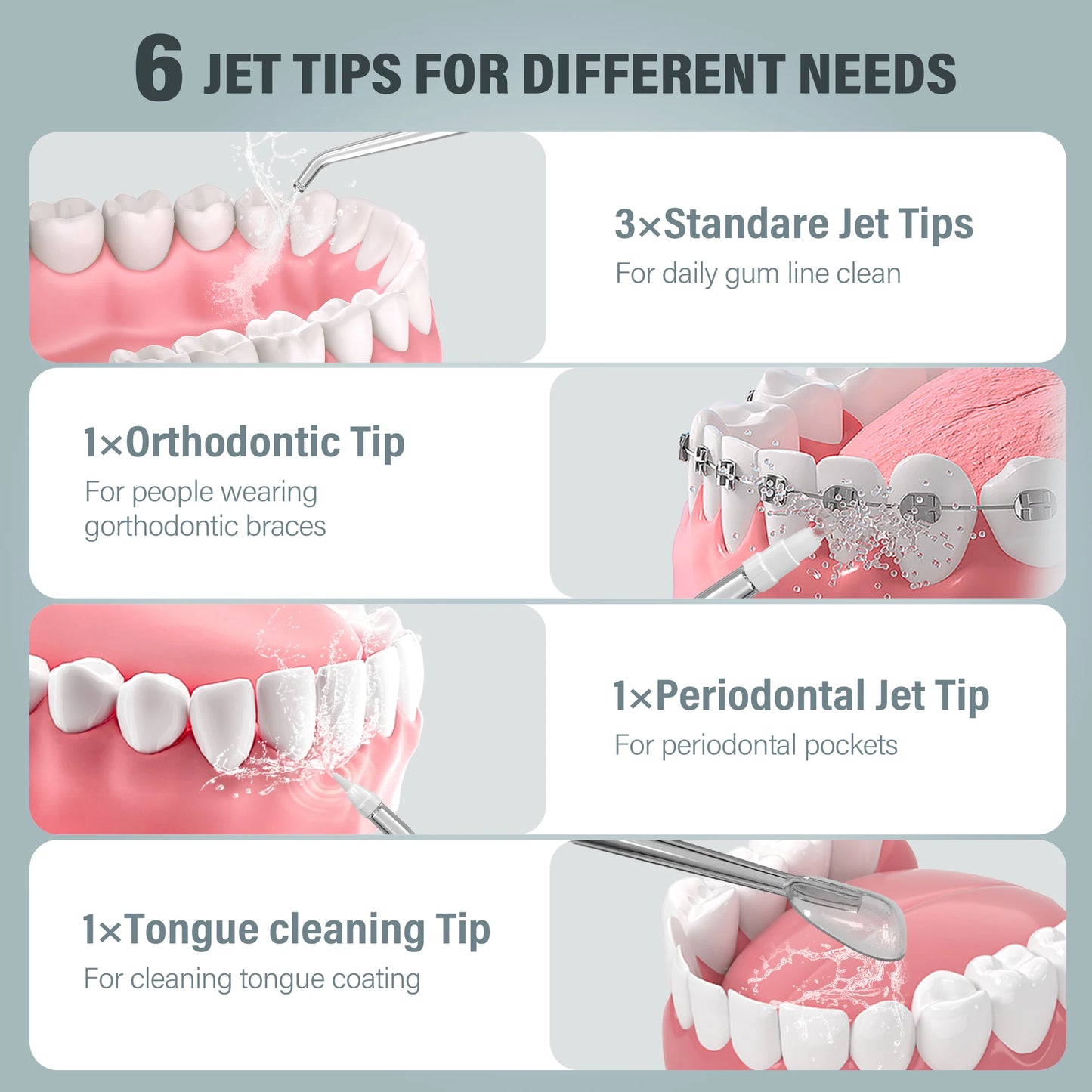 Irigator oral 2025: Irigator oral Sejoy Dental cu apă - Curățitor de dinți cu 4 duze și 4 moduri pentru îngrijire dentară profesională