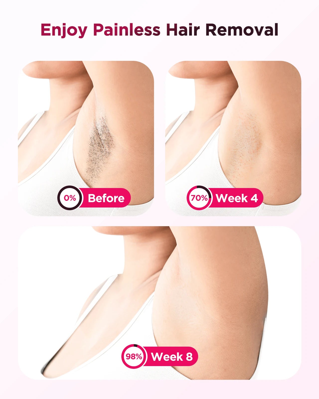 IPL Epilator - Professionelle Haarentfernung 2025