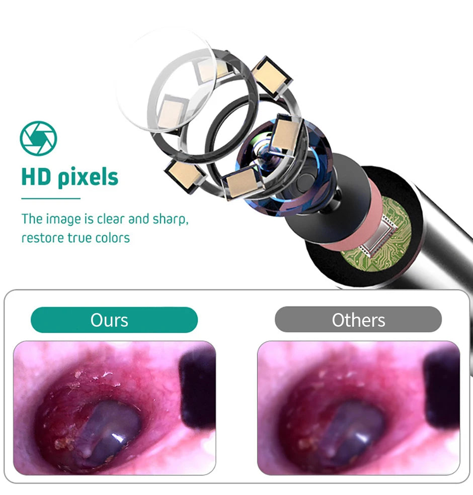 Digital Otoscope with Gyroscope 3.9MM 4.5 " IPS Ear Scope Camera 1080P Ear Wax Removal Tool For Home Ear Infection Detector