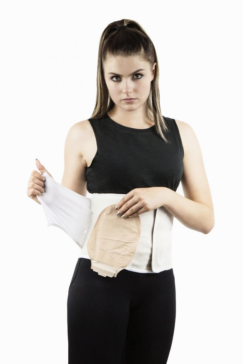 Stomă cu bandaj abdominal - AT04603