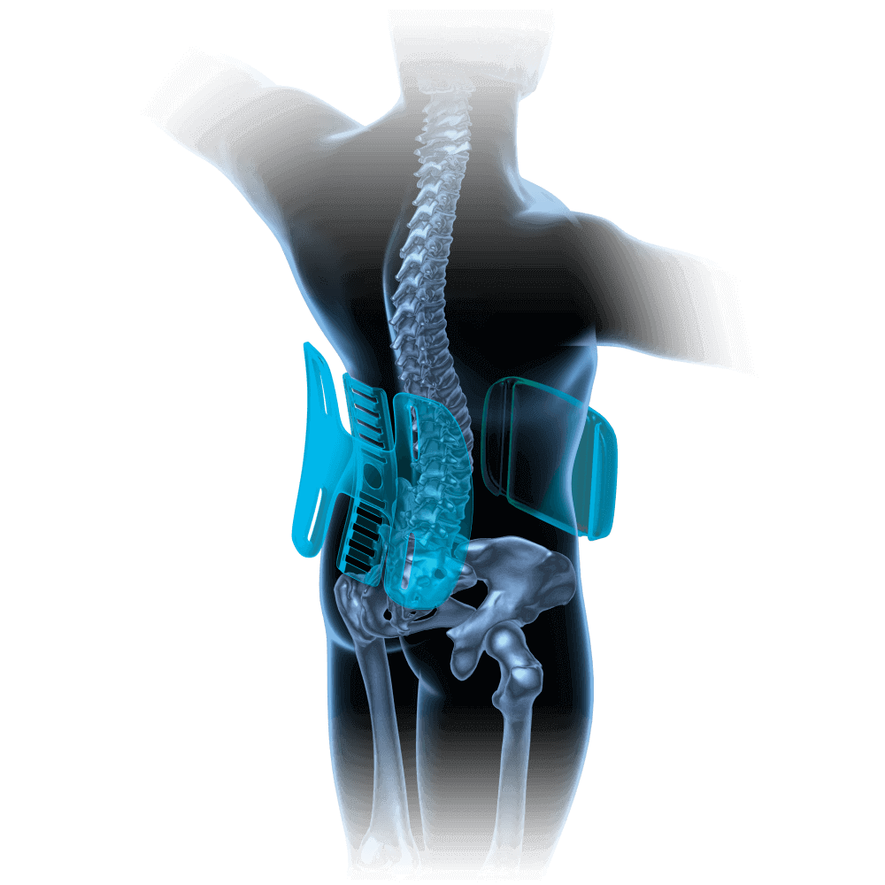 Orteză spinală Lumbar Secure AccuTex - Oppo 2952