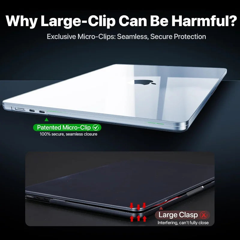 MacBook-Hülle 2025: Ultra-Clear Hard-Case 13.6" - M4-M2 Protection Collection