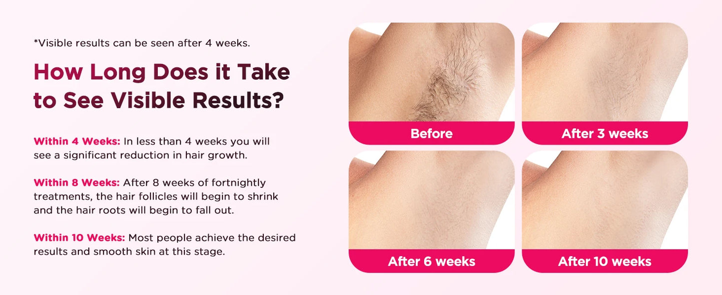 IPL Epilator - Professionelle Haarentfernung 2025